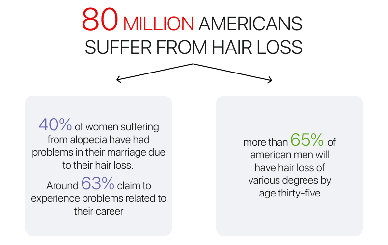 Hair loss statistics in the US